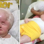 Girl born with gigantic head that refuses to stop growing stuns doctors 30 years later