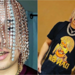 Rapper had surgery to get gold chains implanted into his skull